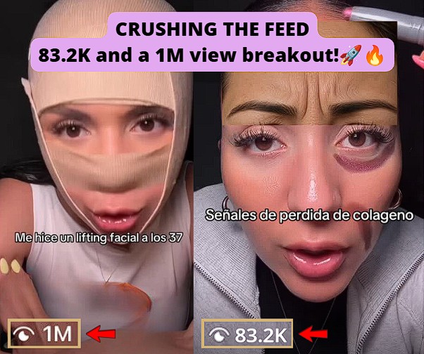 IG Reel reached 83.2K and 1M views.